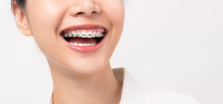 Top Orthodontic Treatments For Your Perfect Smile Jpg