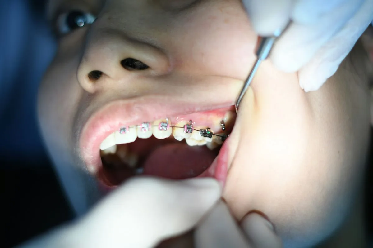 10-signs-you-might-need-to-visit-a-dentist-soon