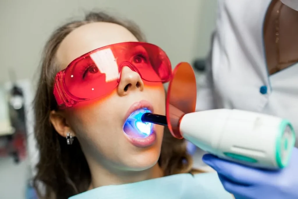 everything-you-need-to-know-about-dental-sealants