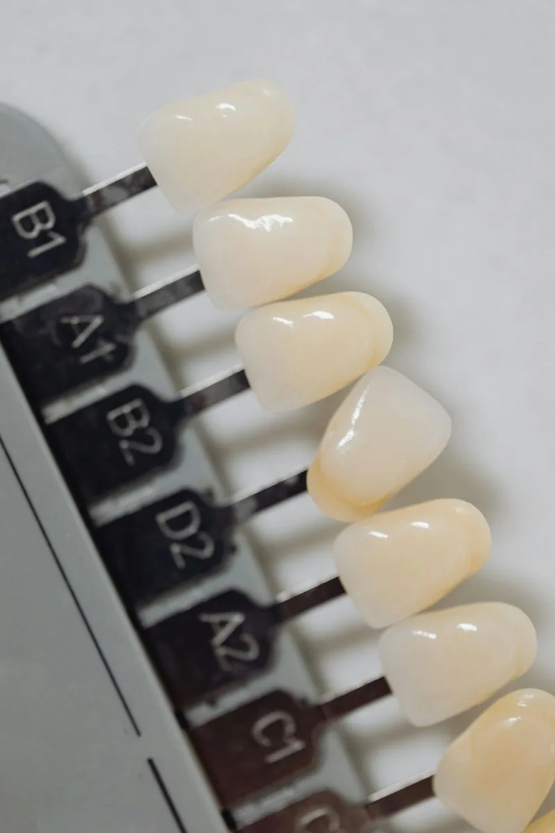 tooth-discoloration-types-and-treatment