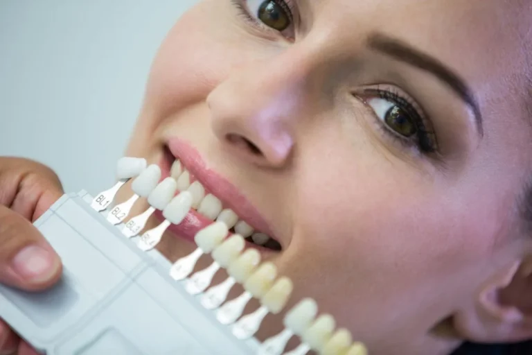 dental-implants-vs-bridges-pros-and-cons