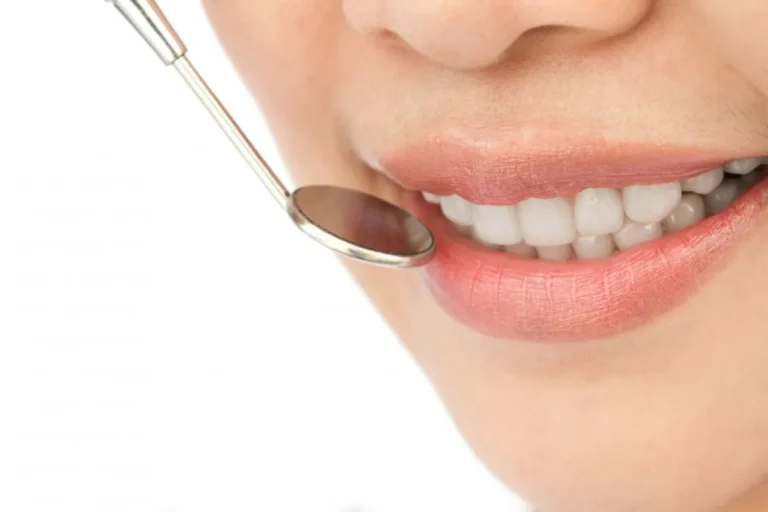 how-to-keep-your-dental-veneers-looking-new